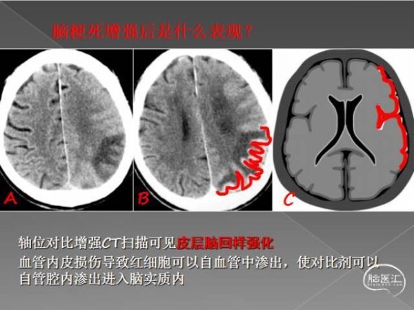 dnf科技哪个稳定点最佳选择