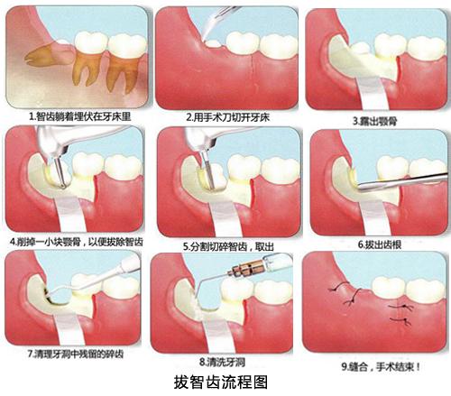 精英台球破解版下载,畅享无广告游戏体验